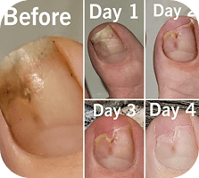 Bailey D. daily progress photos
